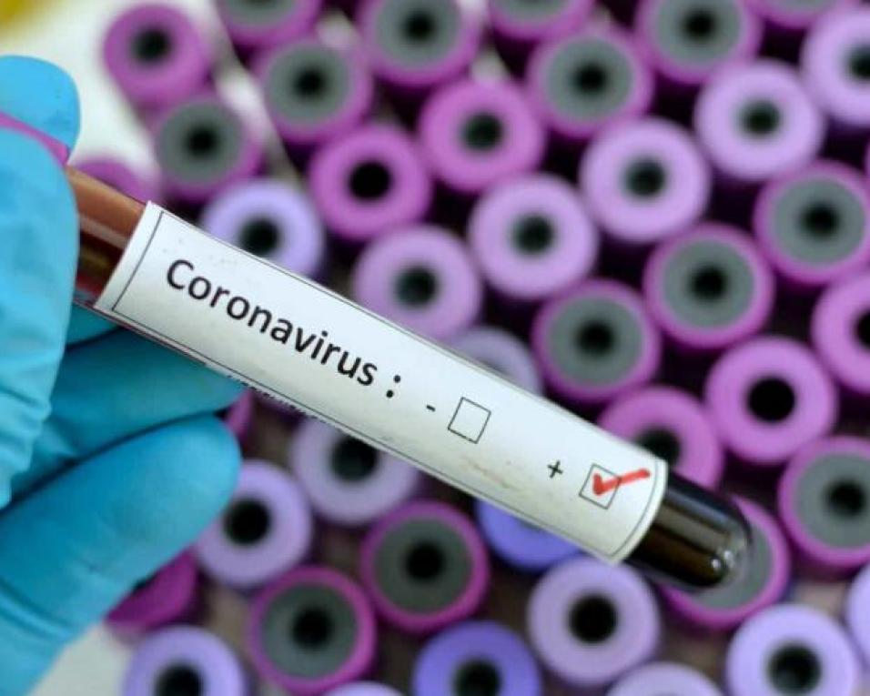 Pandemia: Arouca com 200 casos ativos de Covid-19.