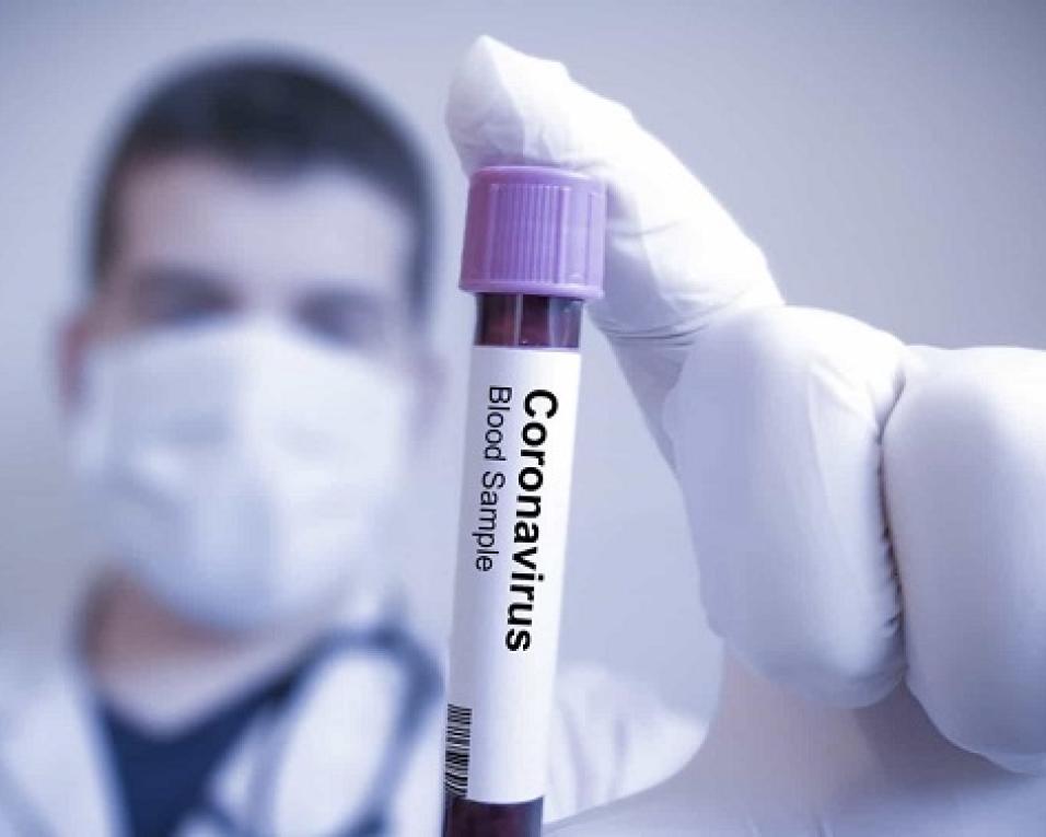 Covid19: Região de Aveiro com 1051 casos confirmados. Covid19: Região de Aveiro com 1051 casos confirmados.