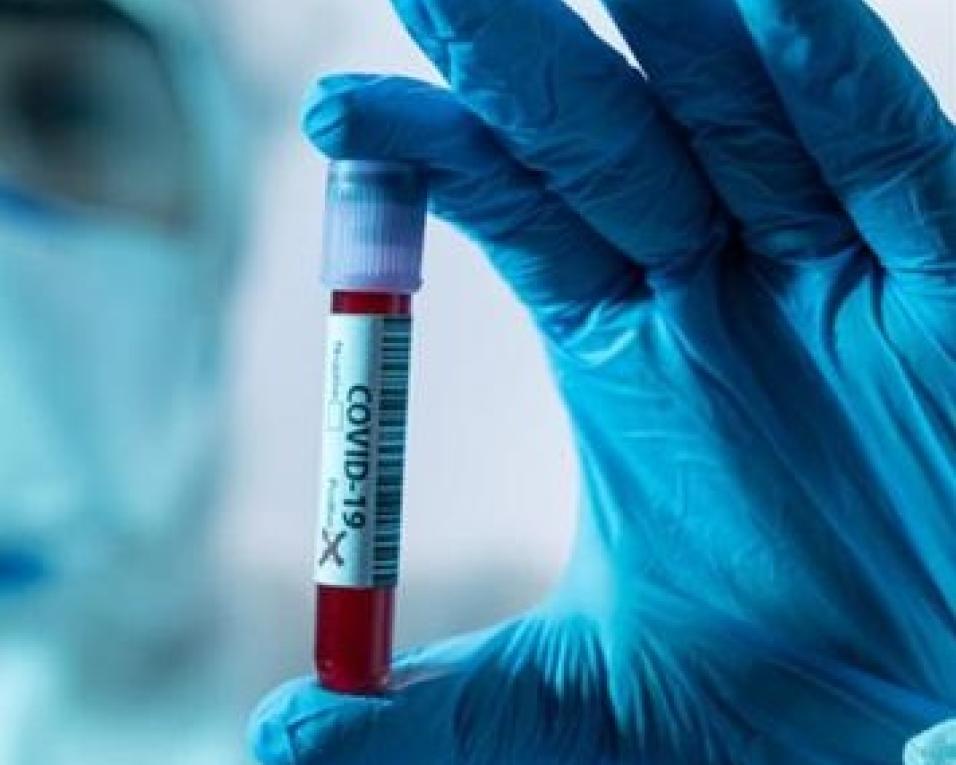 Covid-19: 15 novos óbitos e 480 infetados nas últimas 24 horas. Recuperados disparam. Covid-19: 15 novos óbitos e 480 infetados nas últimas 24 horas. Recuperados disparam.
