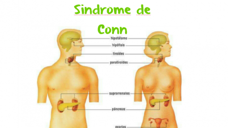 Pela Nossa Saúde - T4. Ep 26 Sistema Endócrino - Glândula suprarrenal (Síndrome de Conn)