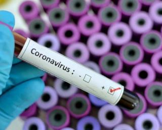 Pandemia: Arouca com 200 casos ativos de Covid-19.