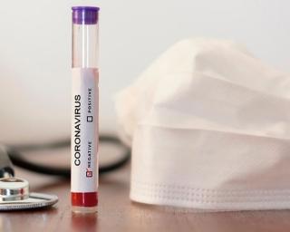 Covid-19: UA regista 78 casos positivos.