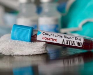 Balanço: Mais 32 mortes e 514 casos de infeção por Covid-19 em Portugal.